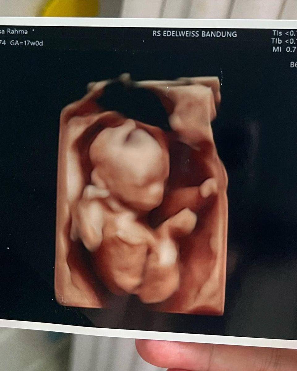 Instagram.com/anisarahma_12